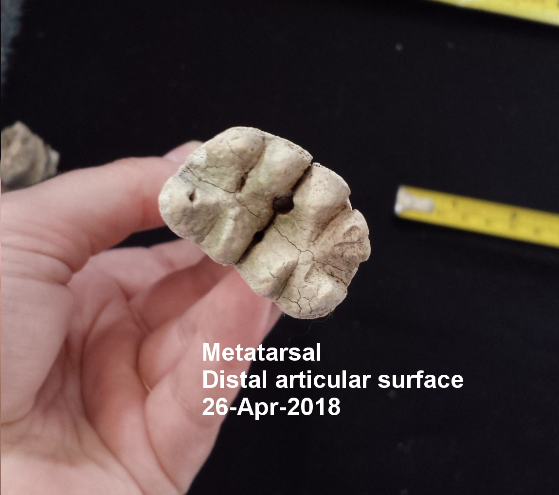 Metatarsal Distal Articular Surface