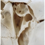 close up of skull bone of the jersey devil-deer skeleton