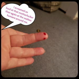 bleeding finger from mouse bite